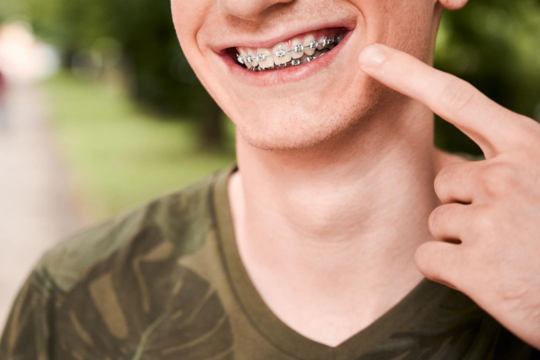 are dental braces painful the truth no one tells you